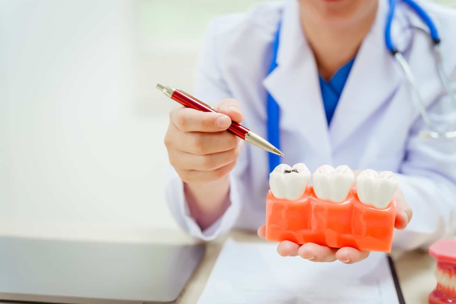 how to prevent cavities