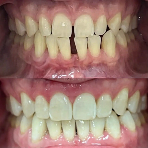 Smile Gallery Before After